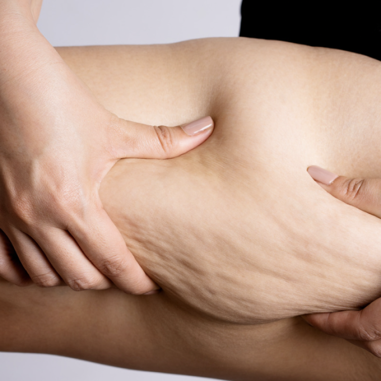 Liposuction Surgeons in Arlington