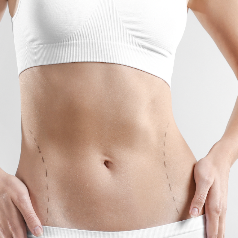 Liposuction Cost in Northern Virginia
