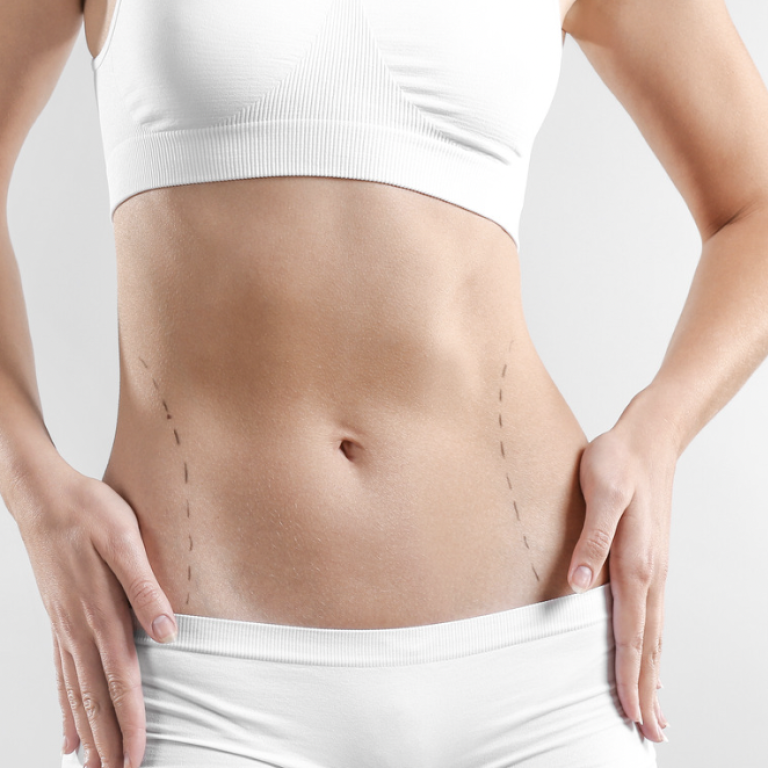 360 Liposuction Cost in Washington