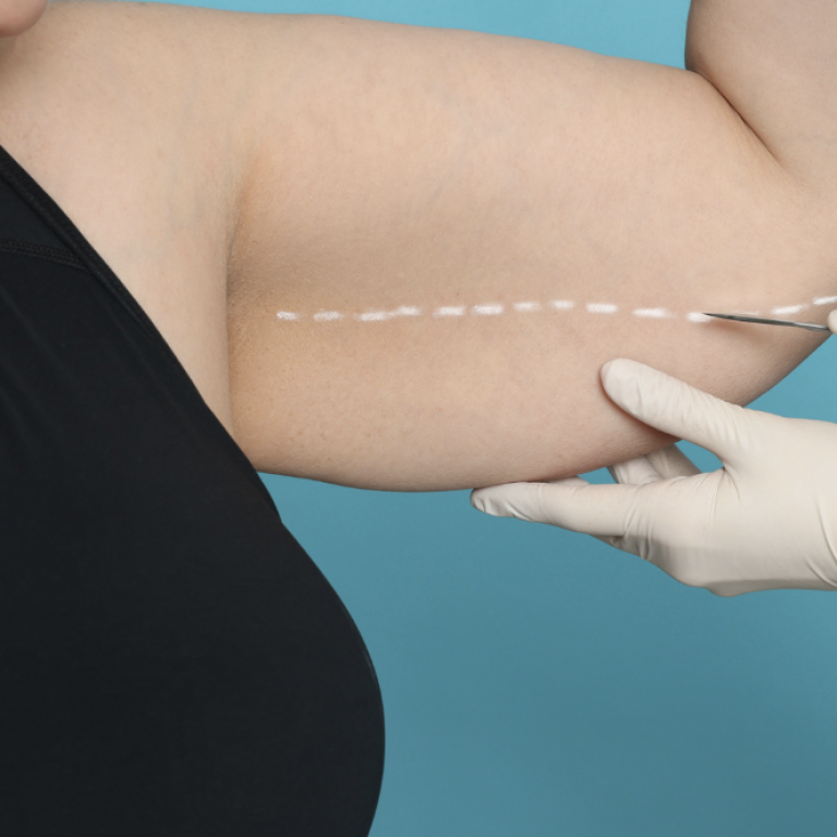 Affordable Liposuction Treatments in Loudoun County