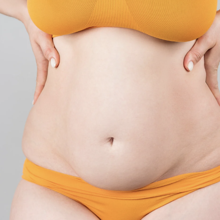Budget-Friendly Liposuction Options in Norfolk Virginia
