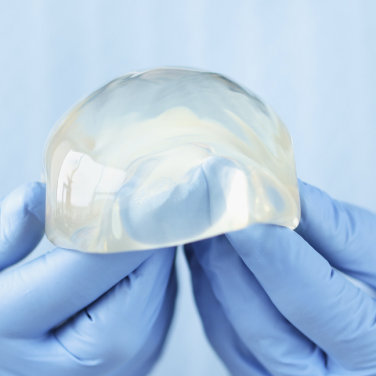 Breast Implant Replacement Costs Explained
