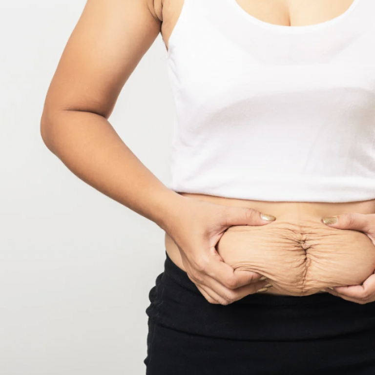 Best Tummy Tuck Pricing in Northern VA
