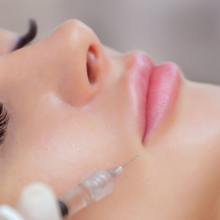 Here's Your Quick Guide to the Best Lip Fillers in Northern Virginia