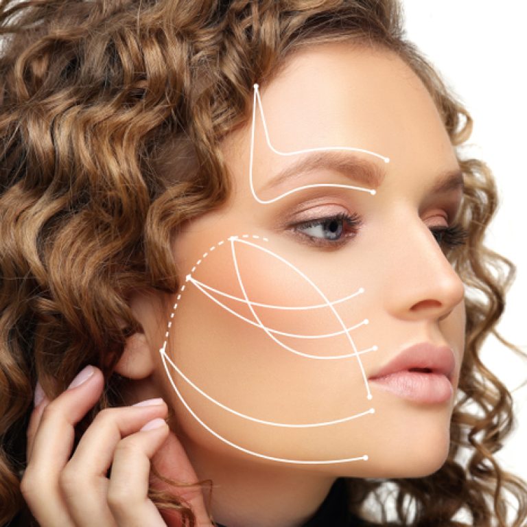 Do I Need a Thread Lift Specialist in Vienna VA?