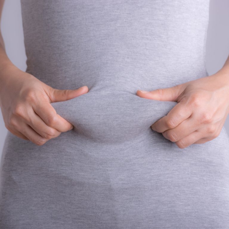 How Much Fat Can Be Removed During Liposuction?
