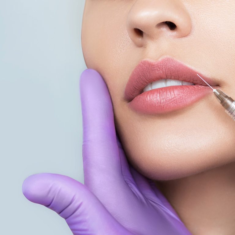 Natural Looking Lip Filler Near Fairfax