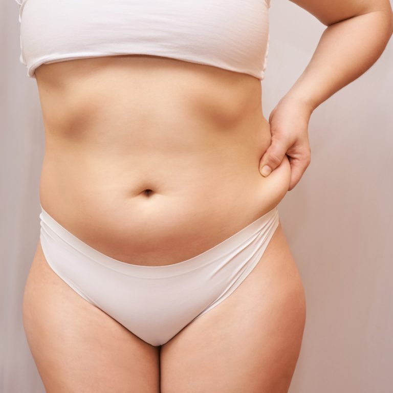 How Much Weight Can You Lose From Liposuction in Washington DC?
