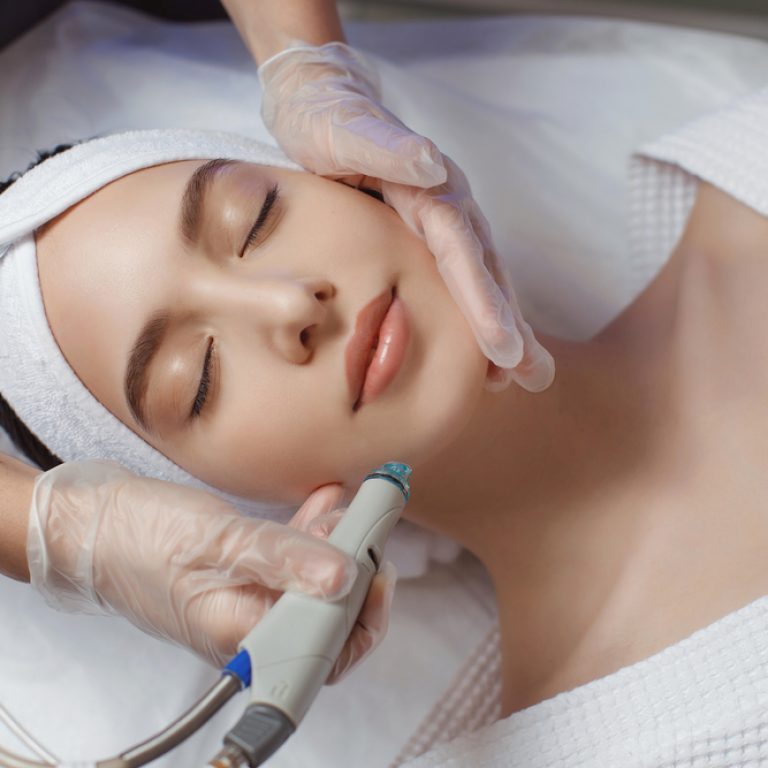HydraFacial Good for Acne in Vienna