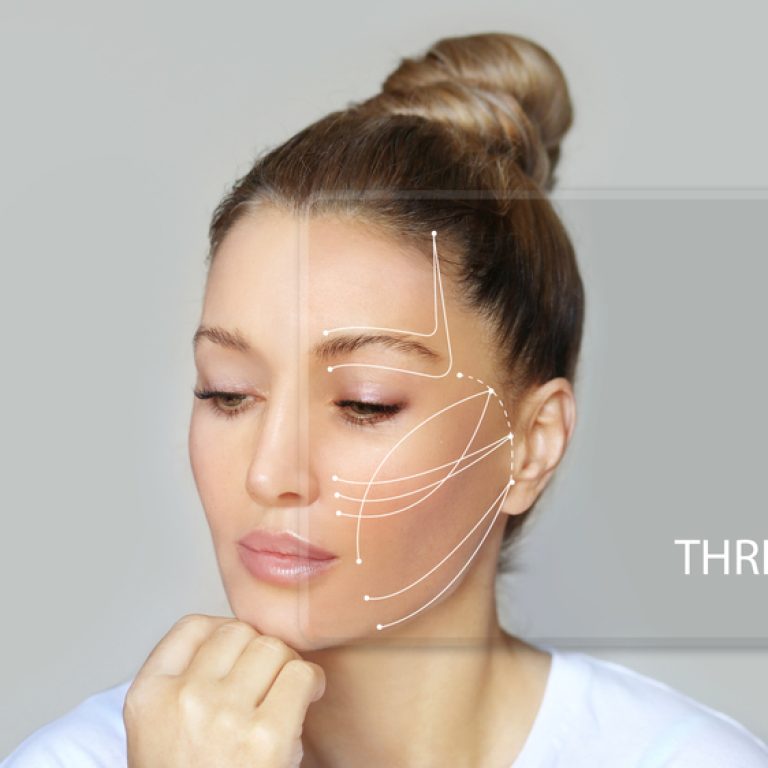 8 Benefits of the Best Thread Lift in McLean