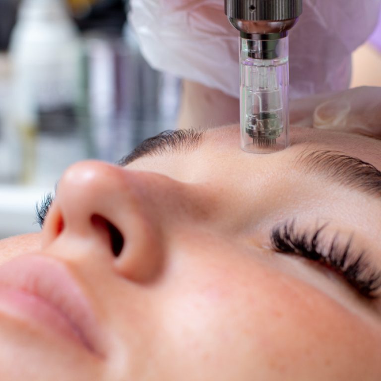 How Much Is Microneedling in Rockville