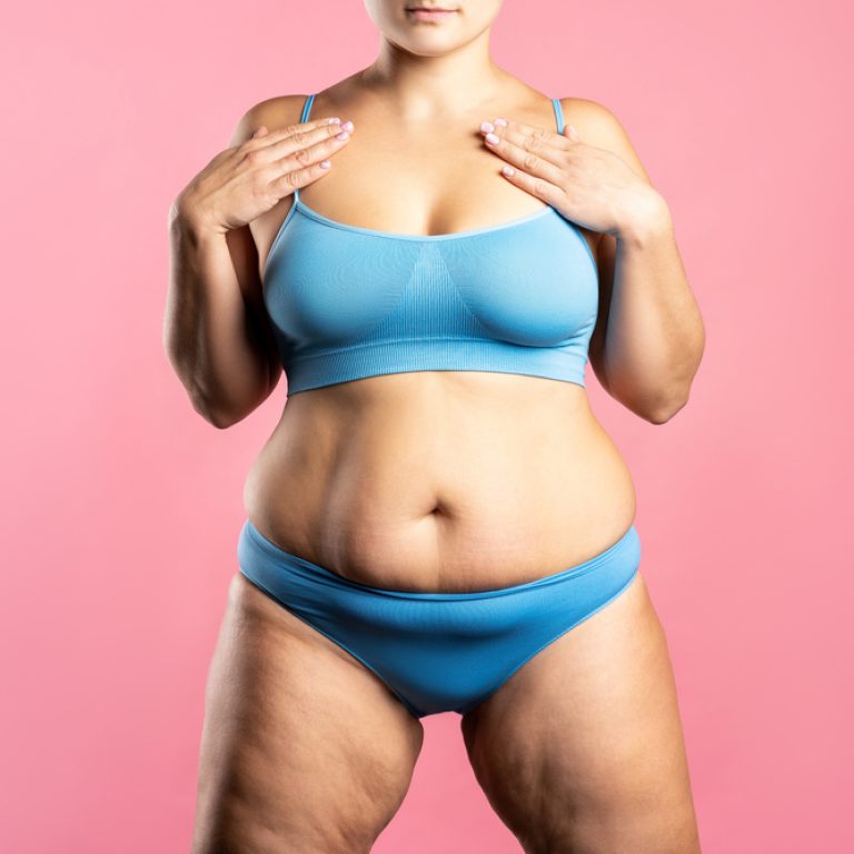 4 Tips for the Best Natural Looking Liposuction Surgeon in Great Falls