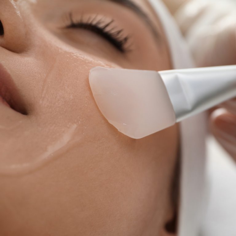 Best Chemical Peels Near Vienna