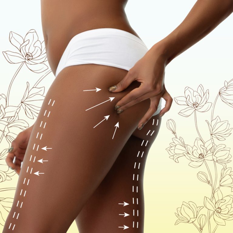 Choosing the Right Liposuction Specialist