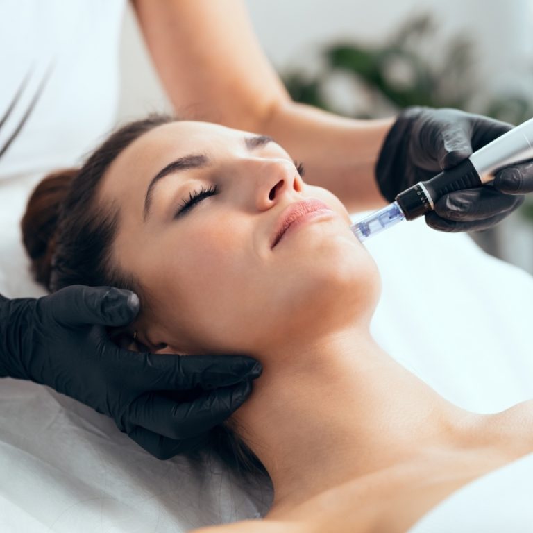 How Long Does Microneedling Last in McLean, Virginia?