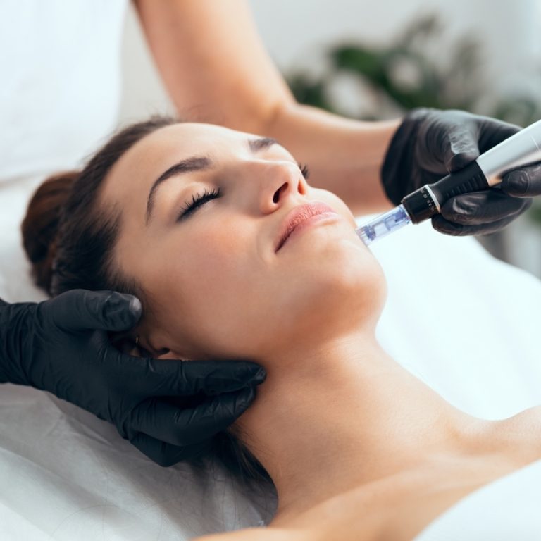 The Truth About Microneedling Costs in Vienna