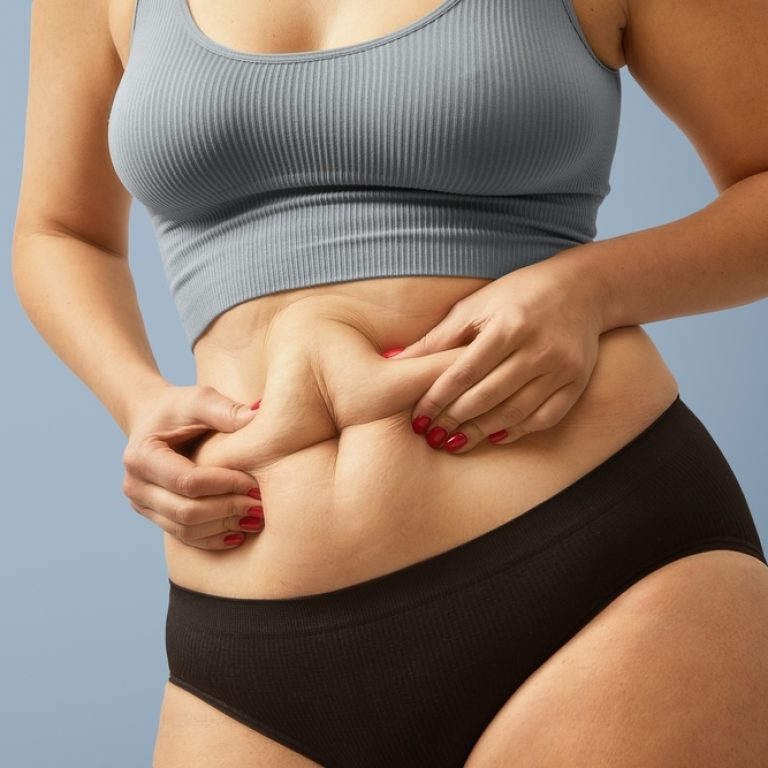 8 Reasons You Need the Best Tummy Tuck Revision Surgeon in Virginia