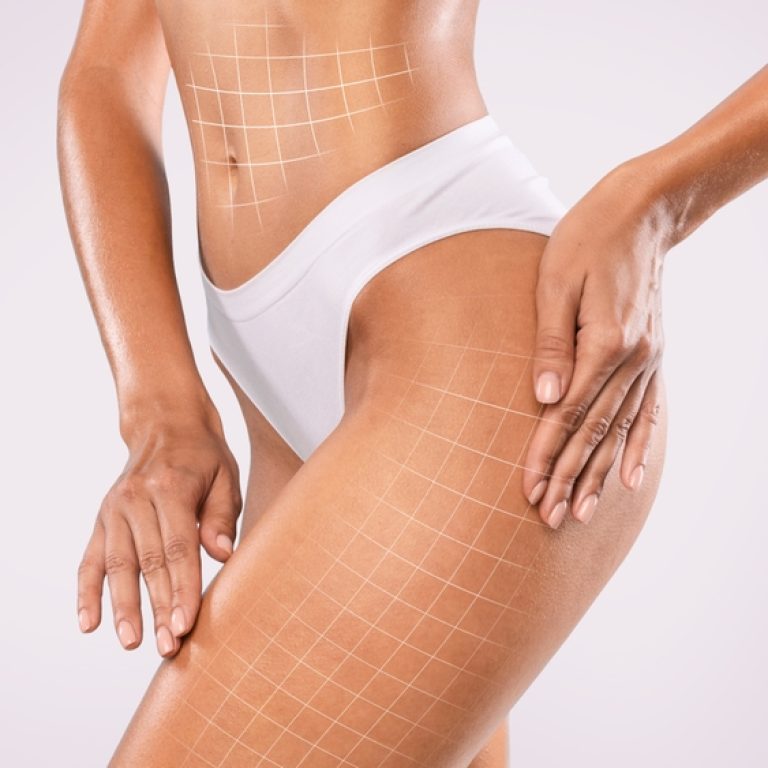 Here’s the Secret to the Best 360 Liposuction in Tysons Corner, Virginia