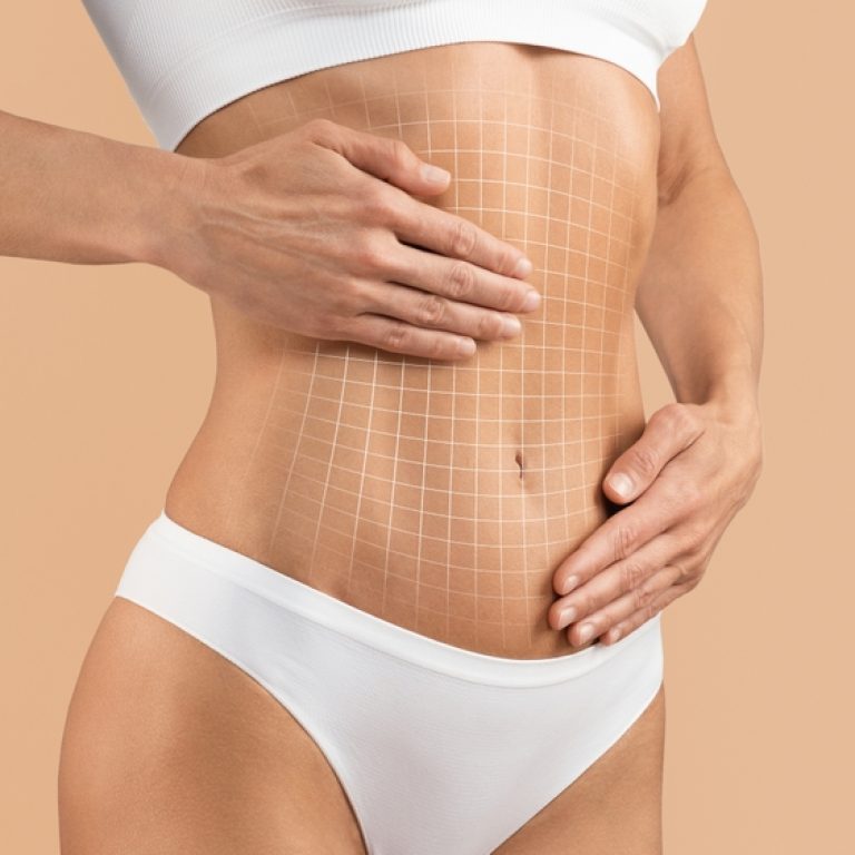 Get the Tummy Tuck Cost in Reston