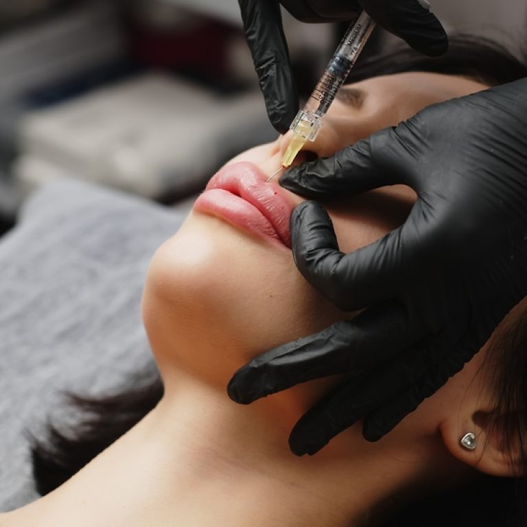 How Much Does the Best Lip Filler Cost?