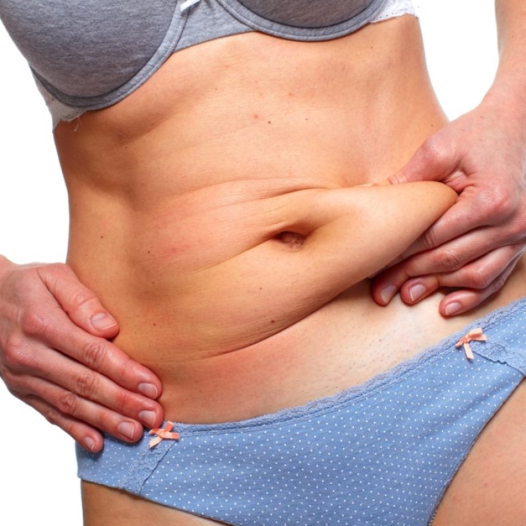 How Much Does a Tummy Tuck Cost in Fairfax