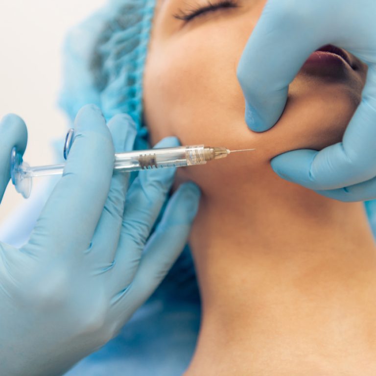6 Exciting Facts About Jawline Fillers in Vienna VA
