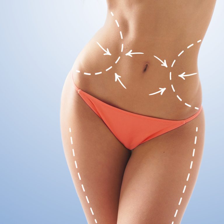 Northern Virginia Lipo Prices
